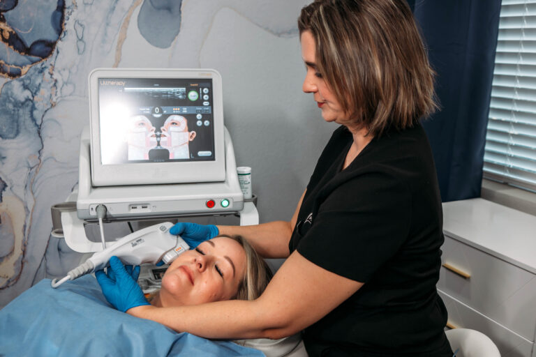 Ultherapy 2